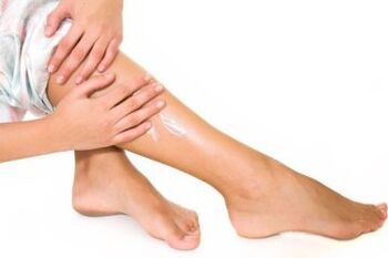 Varicose vein treatment