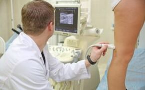 Methods for the treatment of varicose veins in the feet in women